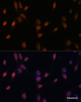 Immunofluorescence analysis of NIH-3T3 cells using USP33 Polyclonal Antibody at dilution of 1:100 (40x lens) . Blue: DAPI for nuclear staining.