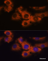 Immunofluorescence analysis of C6 cells using NDRG4 Polyclonal Antibody at dilution of 1:100. Blue: DAPI for nuclear staining.