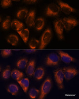 Immunofluorescence analysis of HeLa cells using NDRG4 Polyclonal Antibody at dilution of 1:100. Blue: DAPI for nuclear staining.