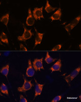 Immunofluorescence analysis of L929 cells using NDRG4 Polyclonal Antibody at dilution of 1:100. Blue: DAPI for nuclear staining.
