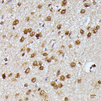 Immunohistochemistry of paraffin-embedded Rat brain using KIAA1429 Polyclonal Antibody at dilution of 1:100 (40x lens) .