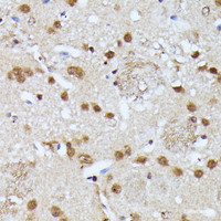 Immunohistochemistry of paraffin-embedded Mouse brain using KIAA1429 Polyclonal Antibody at dilution of 1:100 (40x lens) .