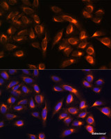 Immunofluorescence analysis of U-2 OS cells using PTCD1 Polyclonal Antibody at dilution of 1:100. Blue: DAPI for nuclear staining.