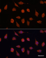 Immunofluorescence analysis of L929 cells using KCNAB2 Polyclonal Antibody at dilution of 1:100. Blue: DAPI for nuclear staining.