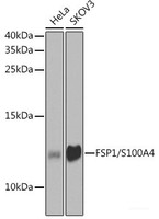 Western blot analysis of extracts of various cell lines using FSP1/S100A4 Polyclonal Antibody at dilution of 1:1000.