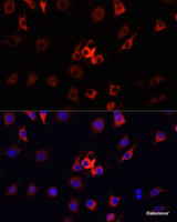 Immunofluorescence analysis of RAW264.7 cells using FSP1/S100A4 Polyclonal Antibody at dilution of 1:100. Blue: DAPI for nuclear staining.