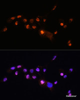 Immunofluorescence analysis of A431 cells using KLF8 Polyclonal Antibody at dilution of 1:100. Blue: DAPI for nuclear staining.