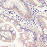 Immunohistochemistry of paraffin-embedded Human small intestine using HMGCR Polyclonal Antibody at dilution of 1:200 (40x lens) .