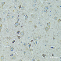 Immunohistochemistry of paraffin-embedded Rat brain using HSPB1 Polyclonal Antibody at dilution of 1:100 (40x lens) .