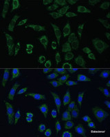 Immunofluorescence analysis of L929 cells using AEBP1 Polyclonal Antibody at dilution of 1:100 (40x lens) . Blue: DAPI for nuclear staining.