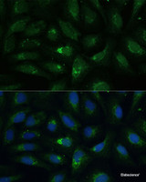 Immunofluorescence analysis of U-2 OS cells using AEBP1 Polyclonal Antibody at dilution of 1:100 (40x lens) . Blue: DAPI for nuclear staining.