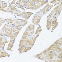 Immunohistochemistry of paraffin-embedded Mouse heart using ASMT Polyclonal Antibody at dilution of 1:100 (40x lens) .