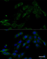 Immunofluorescence analysis of C6 cells using ATP6V0C Polyclonal Antibody at dilution of 1:100 (40x lens) . Blue: DAPI for nuclear staining.