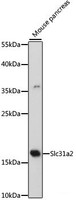 Western blot analysis of extracts of Mouse pancreas using Slc31a2 Polyclonal Antibody at dilution of 1:500.