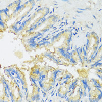 Immunohistochemistry of paraffin-embedded Rat lung using CYP11A1 Polyclonal Antibody at dilution of 1:100 (40x lens) .