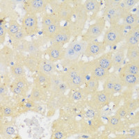 Immunohistochemistry of paraffin-embedded Mouse liver using CYP11A1 Polyclonal Antibody at dilution of 1:100 (40x lens) .