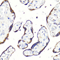 Immunohistochemistry of paraffin-embedded Human placenta using HBEGF Polyclonal Antibody at dilution of 1:100 (40x lens) .