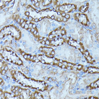 Immunohistochemistry of paraffin-embedded Rat kidney using FGD1 Polyclonal Antibody at dilution of 1:100 (40x lens) .
