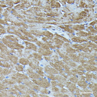 Immunohistochemistry of paraffin-embedded Rat heart using FGD1 Polyclonal Antibody at dilution of 1:100 (40x lens) .