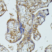 Immunohistochemistry of paraffin-embedded Human placenta using FGD1 Polyclonal Antibody at dilution of 1:100 (40x lens) .