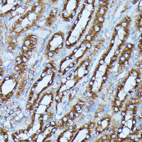 Immunohistochemistry of paraffin-embedded Mouse kidney using FGD1 Polyclonal Antibody at dilution of 1:100 (40x lens) .