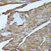 Immunohistochemistry of paraffin-embedded Mouse heart using FGD1 Polyclonal Antibody at dilution of 1:100 (40x lens) .