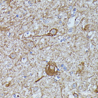 Immunohistochemistry of paraffin-embedded Mouse spinal cord using FKBP1B Polyclonal Antibody at dilution of 1:100 (40x lens) .