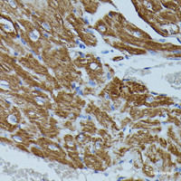 Immunohistochemistry of paraffin-embedded Mouse heart using FKBP1B Polyclonal Antibody at dilution of 1:100 (40x lens) .
