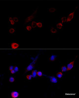 Immunofluorescence analysis of NIH/3T3 cells using FLNA Polyclonal Antibody at dilution of 1:100 (40x lens) . Blue: DAPI for nuclear staining.