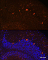 Immunofluorescence analysis of Mouse brain using KAL1 Polyclonal Antibody at dilution of 1:100. Blue: DAPI for nuclear staining.