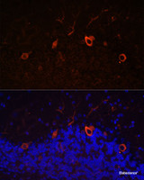 Immunofluorescence analysis of Mouse brain using KAL1 Polyclonal Antibody at dilution of 1:100. Blue: DAPI for nuclear staining.