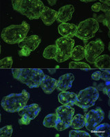 Immunofluorescence analysis of Human placenta using KRT13 Polyclonal Antibody at dilution of 1:100 (40x lens) . Blue: DAPI for nuclear staining.