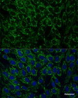 Immunofluorescence analysis of C6 cells using MTIF2 Polyclonal Antibody at dilution of 1:100 (40x lens) . Blue: DAPI for nuclear staining.
