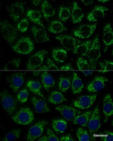 Immunofluorescence analysis of L929 cells using MTIF2 Polyclonal Antibody at dilution of 1:100 (40x lens) . Blue: DAPI for nuclear staining.