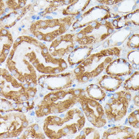 Immunohistochemistry of paraffin-embedded Mouse kidney using NUBP1 Polyclonal Antibody at dilution of 1:100 (40x lens) .