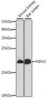 Western blot analysis of extracts of various cell lines using NINJ1 Polyclonal Antibody at dilution of 1:1000.