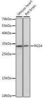 Western blot analysis of extracts of various cell lines using RGS4 Polyclonal Antibody at dilution of 1:1000.