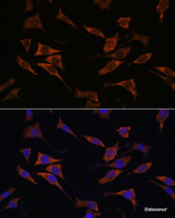 Immunofluorescence analysis of L929 cells using RPS17 Polyclonal Antibody at dilution of 1:100. Blue: DAPI for nuclear staining.