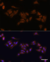 Immunofluorescence analysis of U-2 OS cells using RPS17 Polyclonal Antibody at dilution of 1:100. Blue: DAPI for nuclear staining.