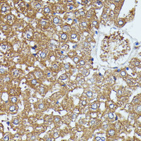 Immunohistochemistry of paraffin-embedded Rat liver using SAA4 Polyclonal Antibody at dilution of 1:100 (40x lens) .