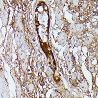 Immunohistochemistry of paraffin-embedded Human plasma using SAA4 Polyclonal Antibody at dilution of 1:100 (40x lens) .