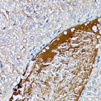 Immunohistochemistry of paraffin-embedded Mouse liver using SAA4 Polyclonal Antibody at dilution of 1:100 (40x lens) .