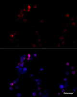 Immunofluorescence analysis of NIH/3T3 cells using TBP Polyclonal Antibody at dilution of 1:100 (40x lens) . Blue: DAPI for nuclear staining.