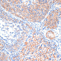 Immunohistochemistry of paraffin-embedded Rat ovary using TIMP2 Polyclonal Antibody at dilution of 1:100 (40x lens) .