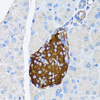 Immunohistochemistry of paraffin-embedded Mouse pancreatic islet using TIMP2 Polyclonal Antibody at dilution of 1:150 (40x lens) .