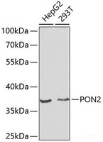 Western blot analysis of extracts of various cell lines using PON2 Polyclonal Antibody at dilution of 1:1000.