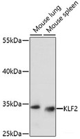 Western blot analysis of extracts of various cell lines using KLF2 Polyclonal Antibody at dilution of 1:1000.