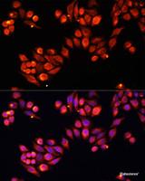 Immunofluorescence analysis of HeLa cells using Heparanase 1 Polyclonal Antibody at dilution of 1:100. Blue: DAPI for nuclear staining.