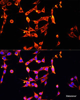 Immunofluorescence analysis of NIH/3T3 cells using Heparanase 1 Polyclonal Antibody at dilution of 1:100. Blue: DAPI for nuclear staining.