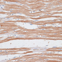 Immunohistochemistry of paraffin-embedded Rat heart using KATNA1 Polyclonal Antibody at dilution of 1:100 (40x lens) .